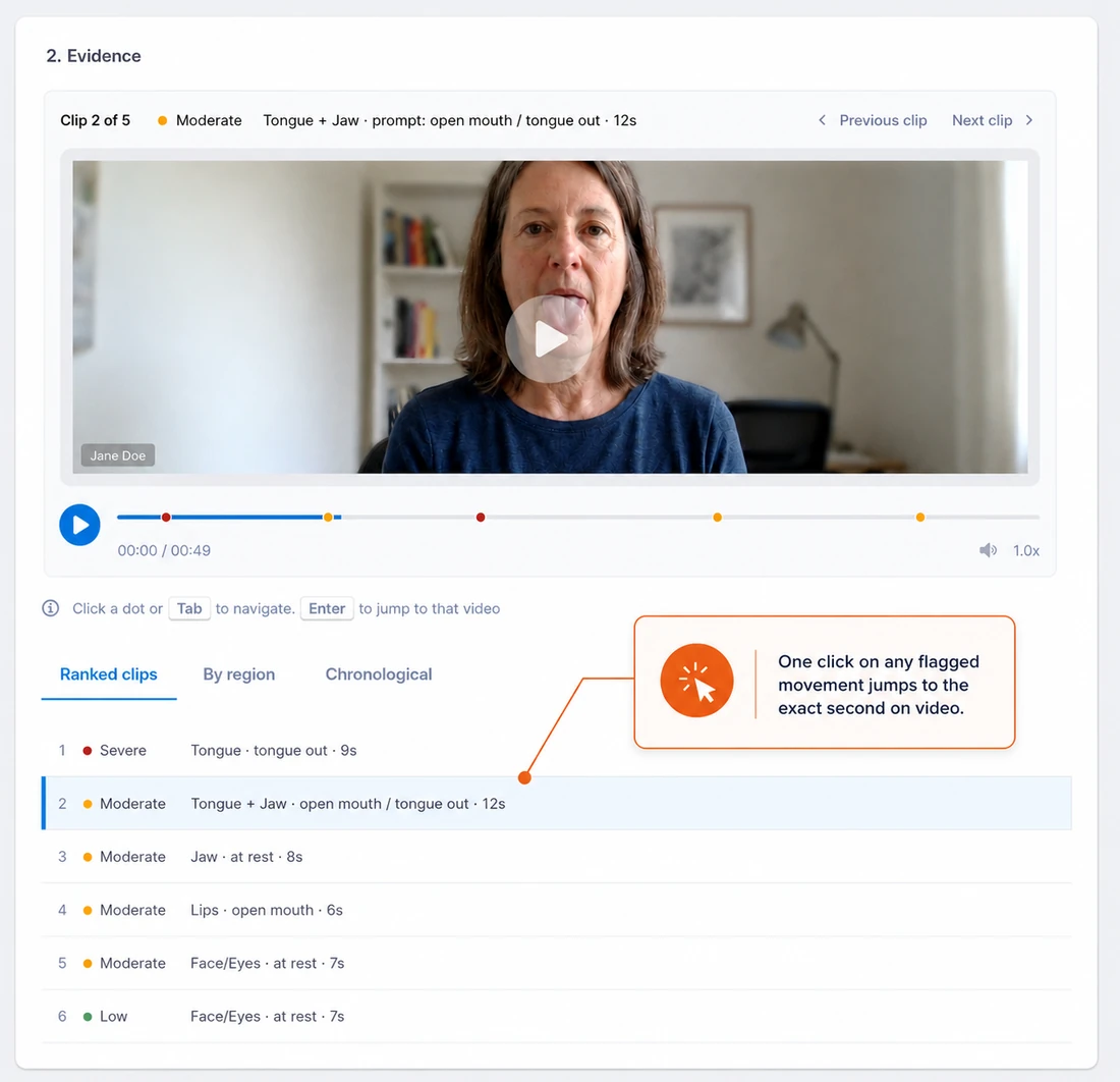 TDScreen evidence view: ranked flagged movements beside the recorded exam, with a callout noting that one click on any flagged movement jumps to the exact second on video.